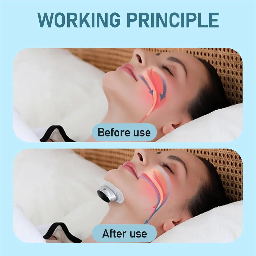 Sleep Sound Anti-Snore Device